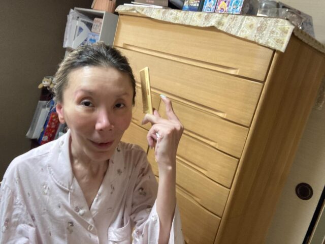 風呂上がりの整容
髪をといて〜
保湿剤塗って〜
ドライヤーで髪を乾かして〜
サラサラになって〜
暑いので2つ結び( *¯ㅿ¯*)ﾌｩ💦
サッパリしました✨️
事業所で作った飾り、素敵でしょ😉
 #身体介助 #家事援助 #通院 #行動援護 #移動支援 #あおいろキャンバス #放課後等デイサービス #zoo #スタッフ募集中 #障害福祉